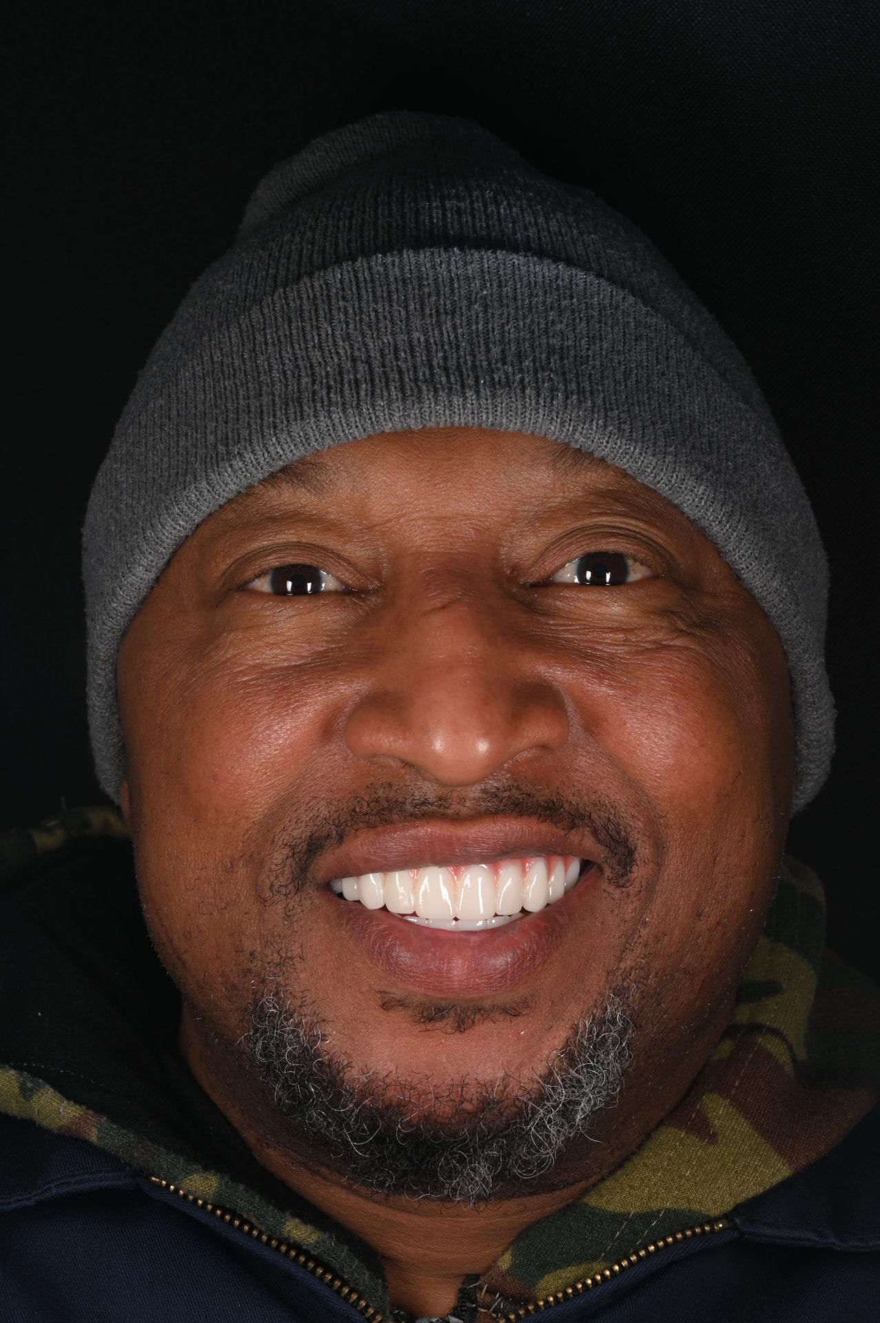 After — Worn, shifting teeth rebuilt — bright, even smile