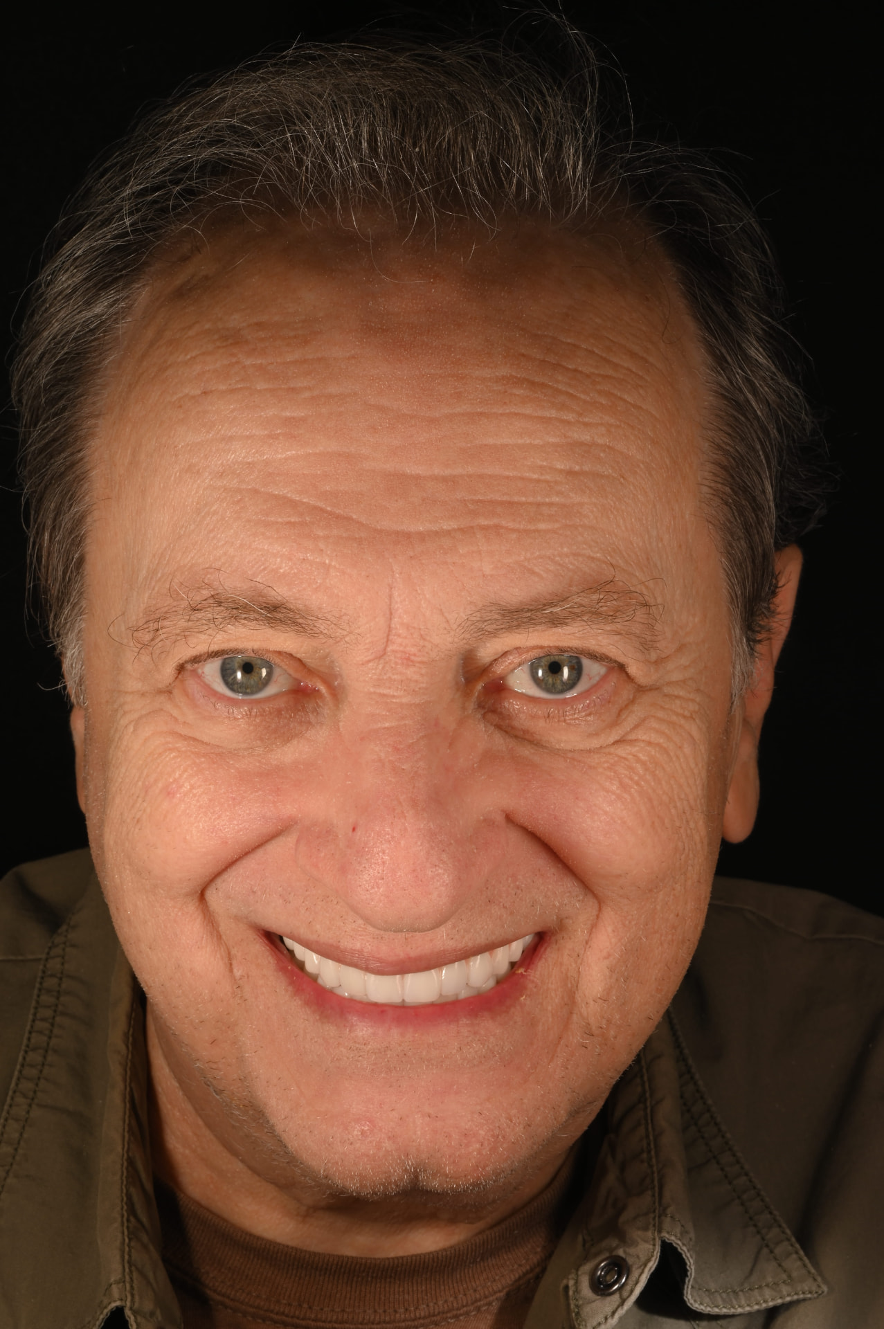 After — Full upper & lower restoration — a whole new smile