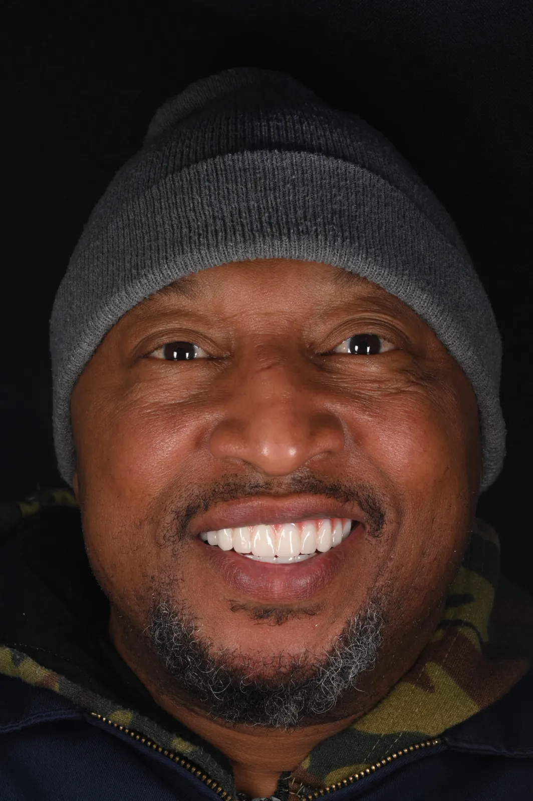After — Worn, shifting teeth rebuilt — bright, even smile