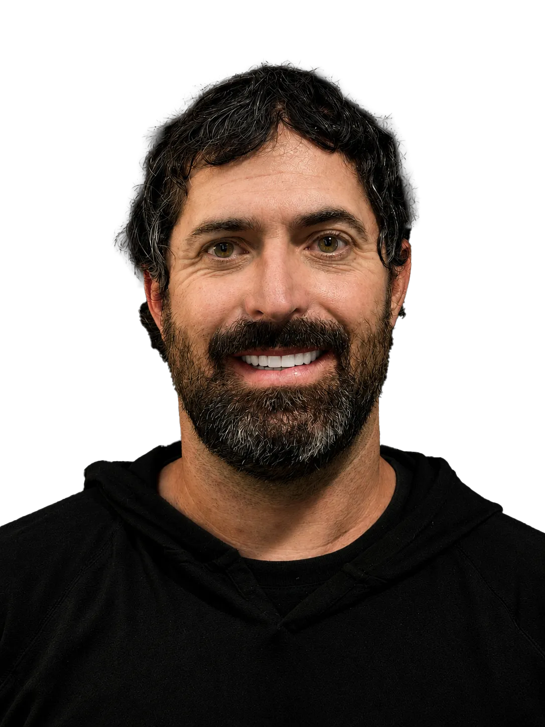 After — Full smile restoration — confidence restored
