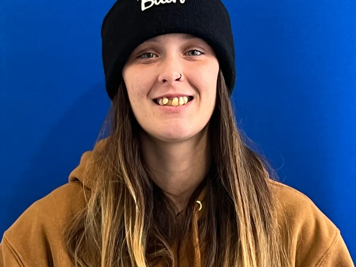 Before — A life-changing transformation — bright, natural smile