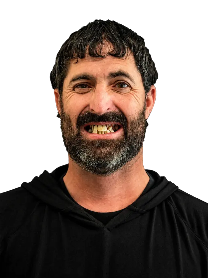 Before — Full smile restoration — confidence restored